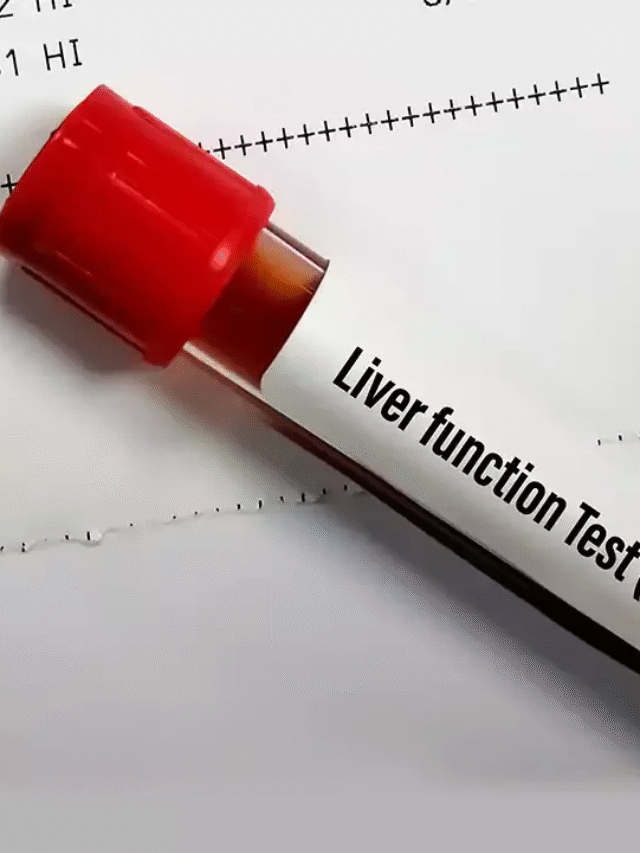 100-50 रुपए के इन छोटे-छोटे ब्लड टेस्ट से पता चलेगा, अगले 10 वर्ष तक आपका लिवर कैसा रहेगा?